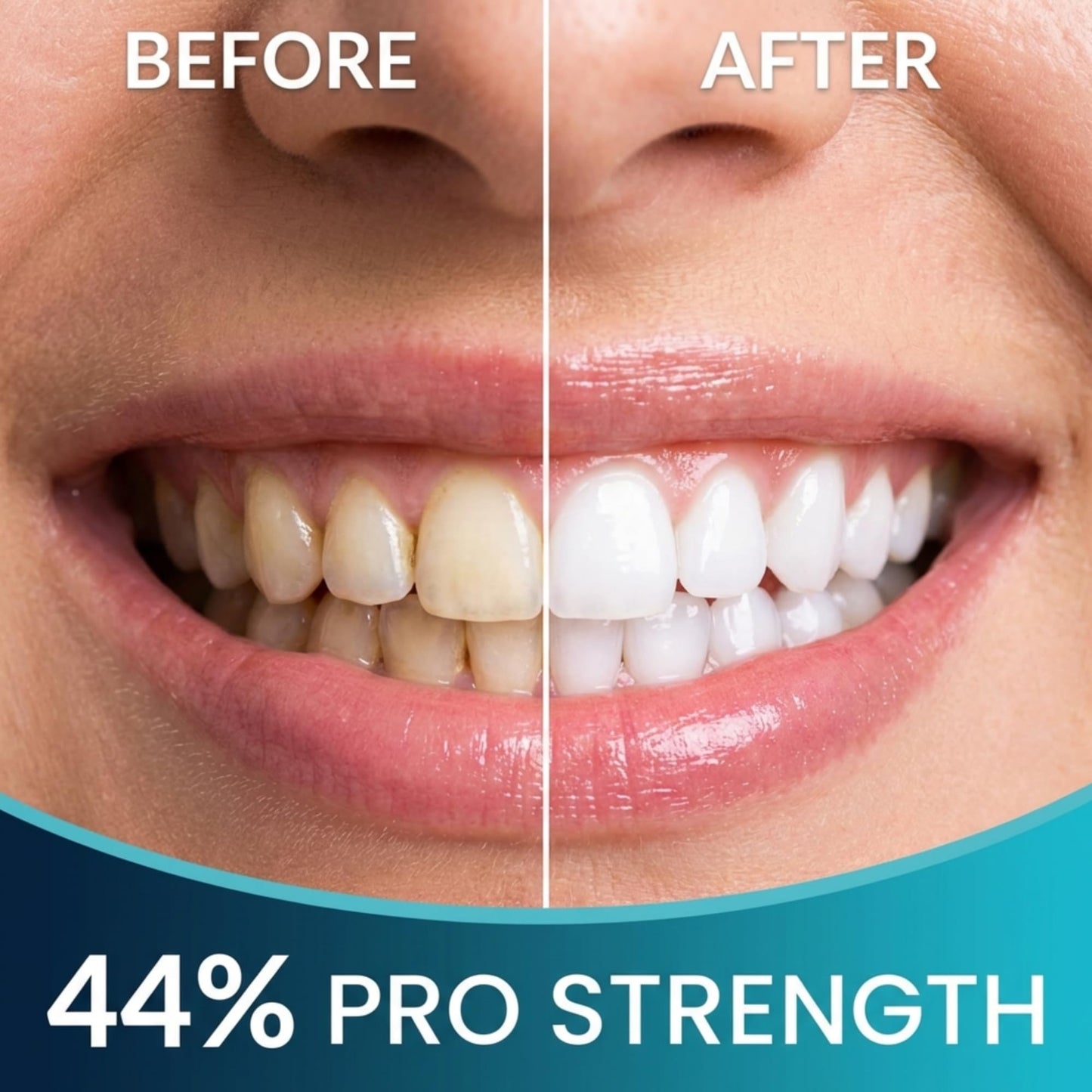 GuruNanda Teeth Whitening Pen